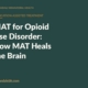 Branded blog hero: MAT for Opioid Use Disorder: How MAT Heals the Brain — Annandale Behavioral Health